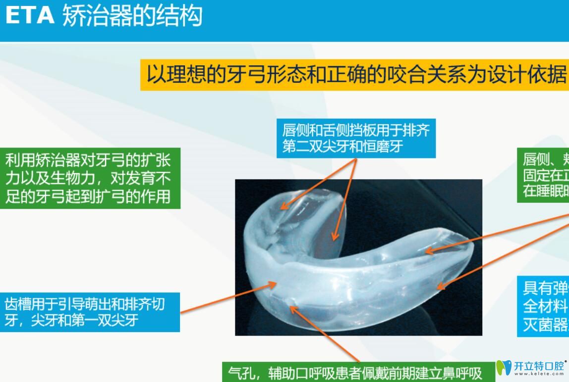 醫(yī)生揭秘：ETA早期矯治技術(shù)是什么？ETA兒童早期矯治好嗎？