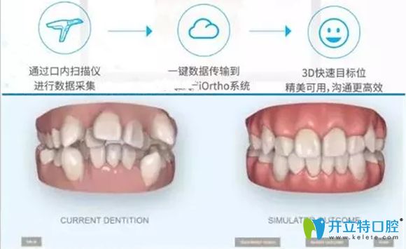 樂山英美口腔的口掃設備圖
