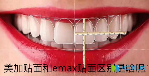 瓷貼面品牌千千萬，帶你了解美加貼面和emax貼面區(qū)別是啥