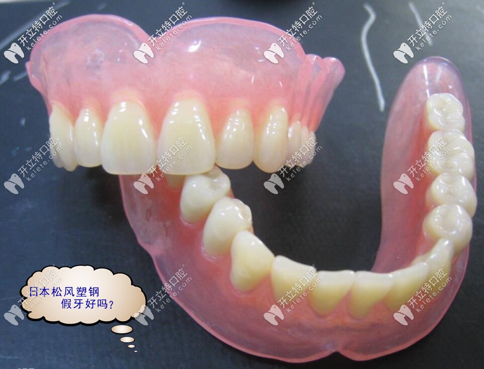 聽(tīng)說(shuō)日本松風(fēng)塑鋼牙假冒的很多,真假到底怎樣區(qū)別？