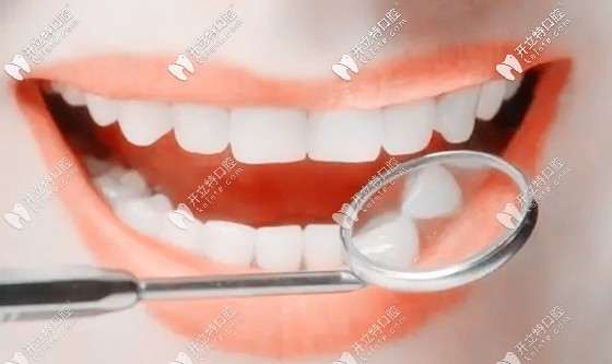對照標(biāo)準(zhǔn)的牙齒咬合圖就可判斷自己到底需不需要整牙哦