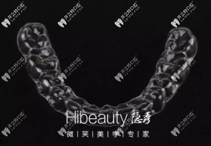 價格貴≠好,國產(chǎn)牙套隱秀和時代天使的這些區(qū)別你知道嗎？