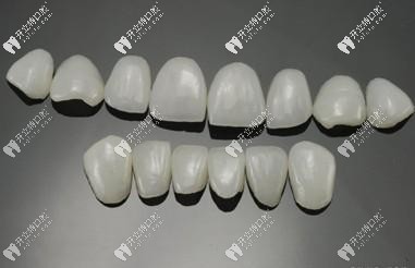 牙齒瓷貼面中的琥珀瓷和藍(lán)瓷貼面區(qū)別大嗎?哪個(gè)好？