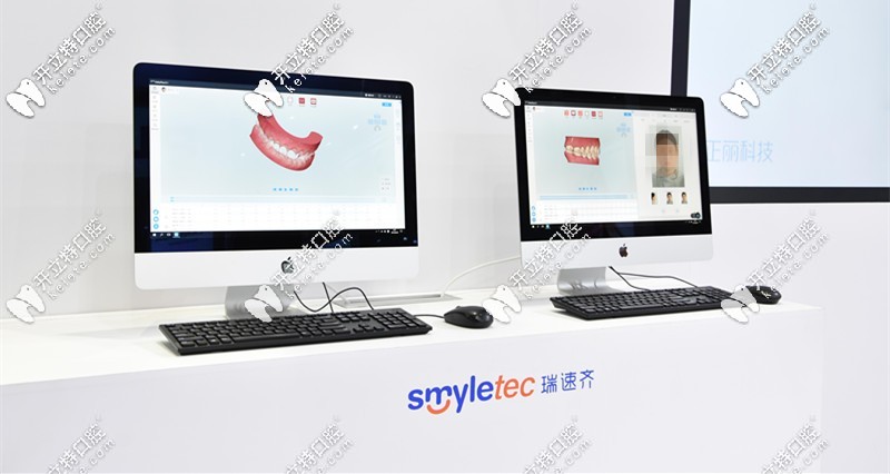 瑞速齊隱形矯正價(jià)格是多少錢？Smyletec是哪個(gè)國(guó)家的？